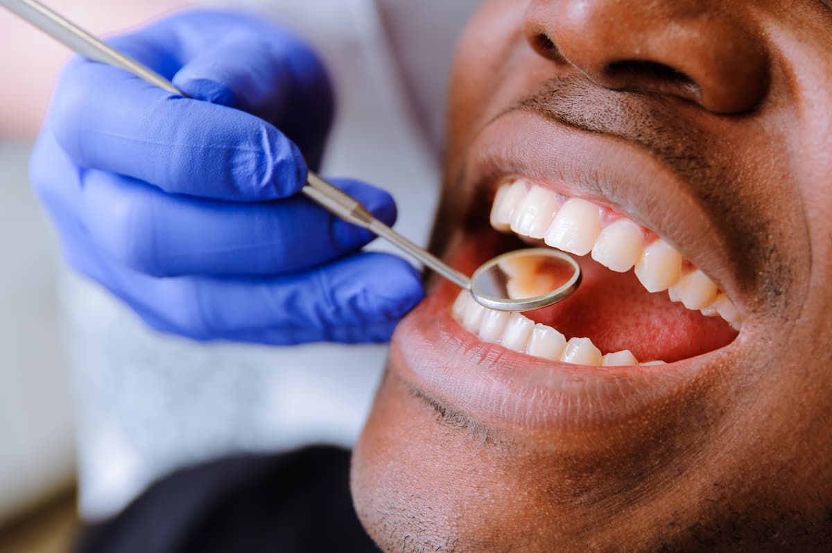 Les problèmes de dents les plus fréquents
