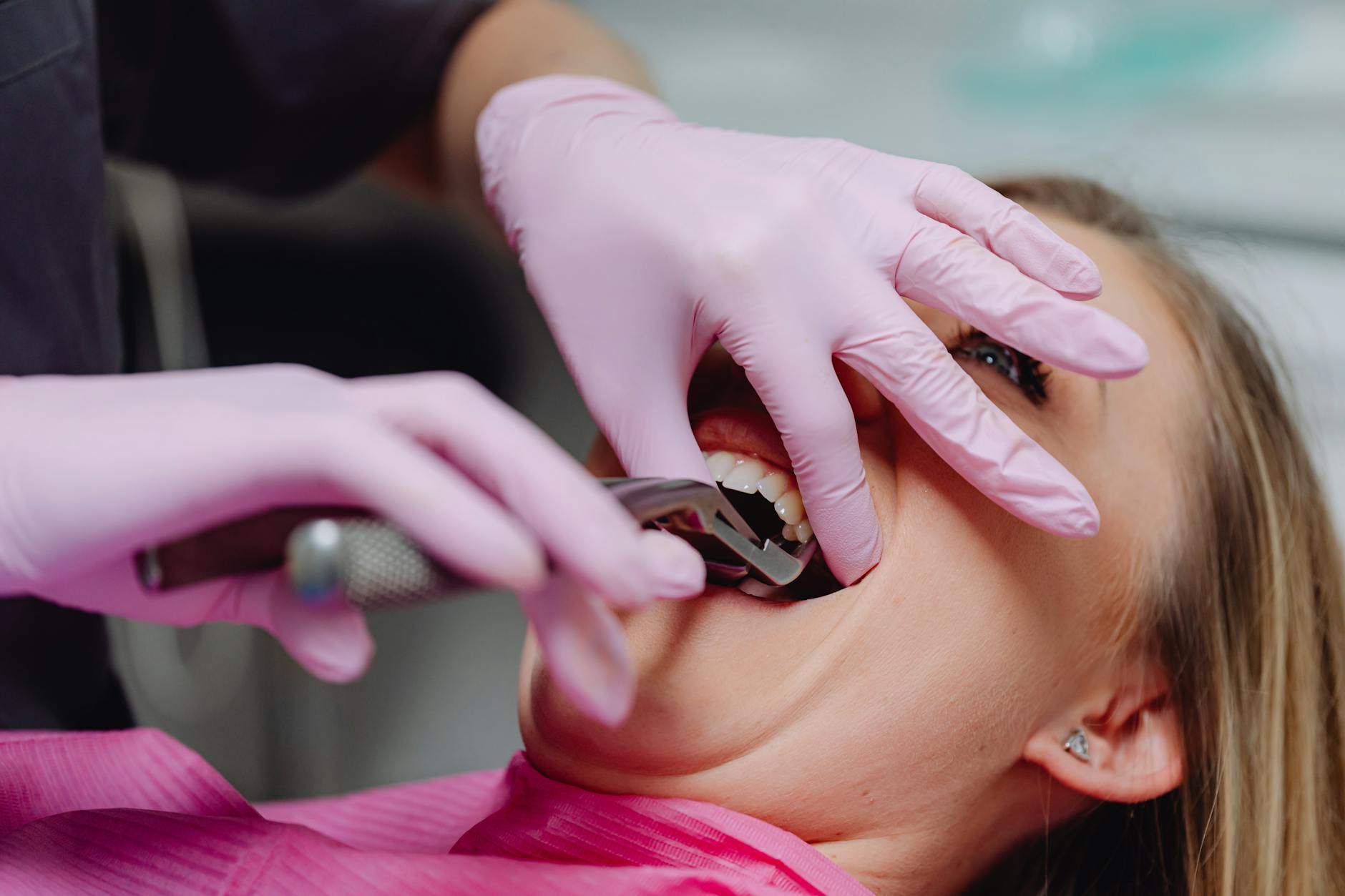 Remède de grand-mère après extraction dent : ce qui marche